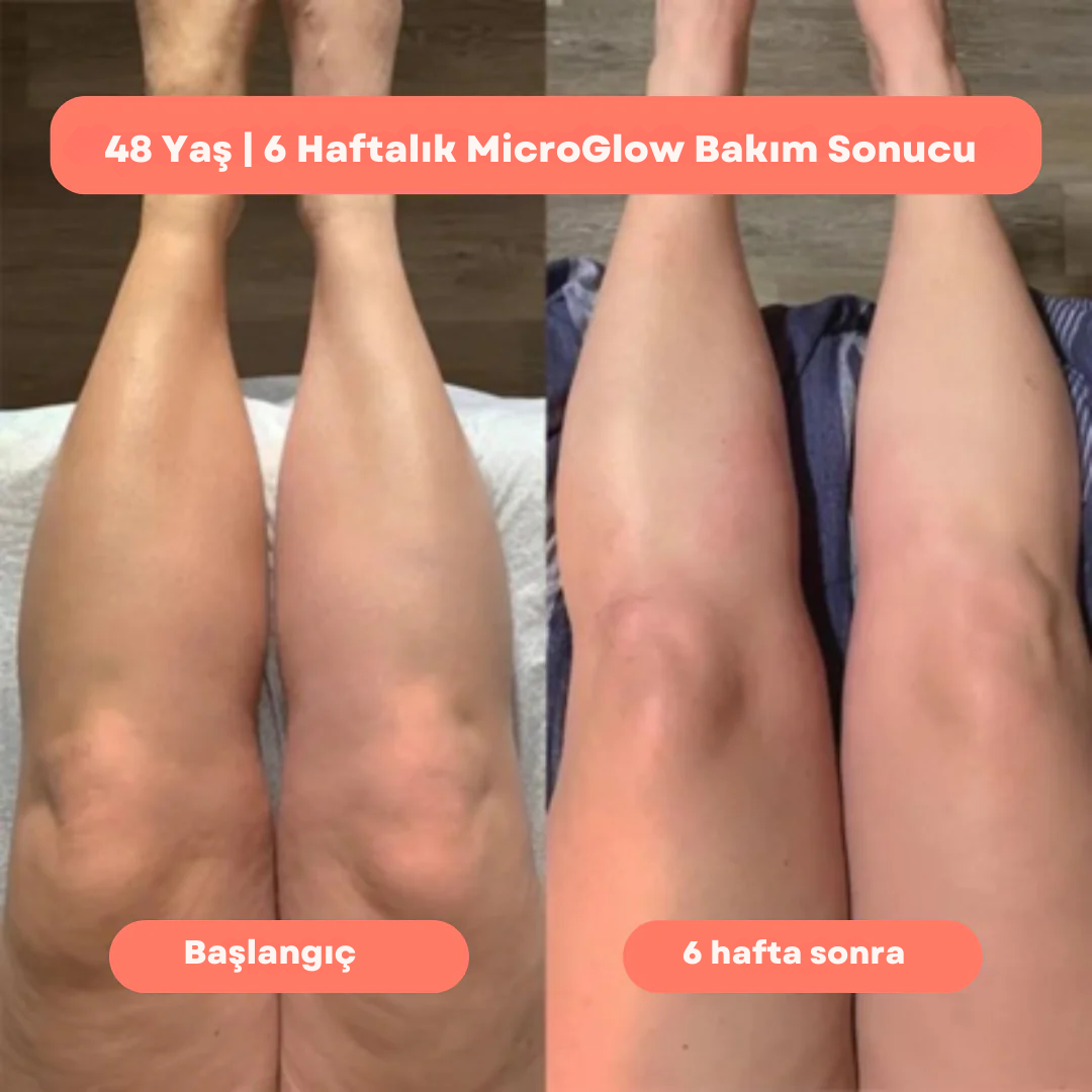 MicroGlow™  Anti Selülit Yağ Seti 80 ML