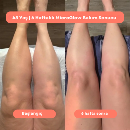 MicroGlow™  Anti Selülit Yağ Seti 80 ML