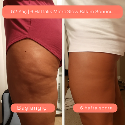 MicroGlow™  Anti Selülit Yağ Seti 80 ML