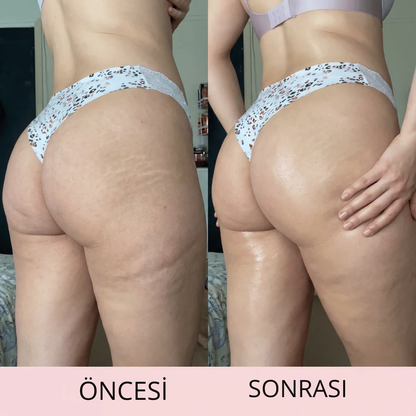 MicroGlow™  Anti Selülit Yağ Seti 80 ML